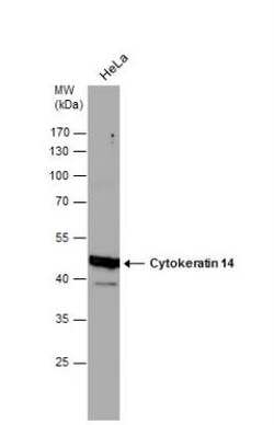Cytokeratin 14 Antibody, Novus Biologicals 0.1mL; Unlabeled:Antibodies,