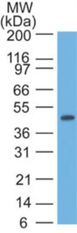 Cytokeratin 17 Antibody (E3 (same as Ks17.E3)), Novus Biologicals 0.1mg;