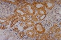 Cytokeratin 18 Antibody (C-04) - BSA Free, Novus Biologicals 0.1mg; Unlabeled:Antibodies,