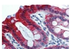 Cytokeratin 18 Antibody (C-04) - BSA Free, Novus Biologicals 0.1mg; Unlabeled:Antibodies,