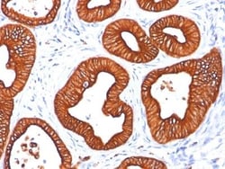 Cytokeratin 18 Antibody (DC10), Novus Biologicals:Antibodies:Primary Antibodies