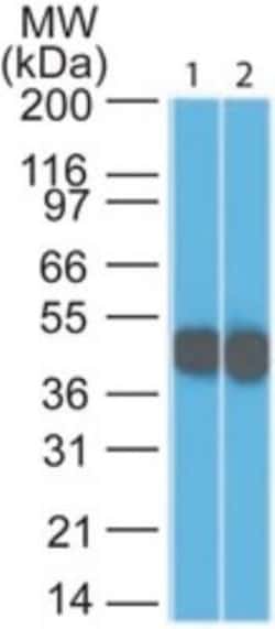 Cytokeratin 18 Antibody (DC10), Novus Biologicals:Antibodies:Primary Antibodies