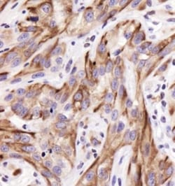 Cytokeratin 19 Antibody - BSA Free, Novus Biologicals 0.025mL; Unlabeled:Antibodies,