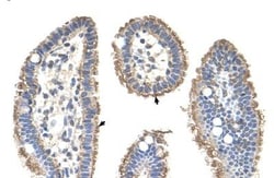 Cytokeratin 2 Antibody, Novus Biologicals 0.05mg; Unlabeled:Antibodies,
