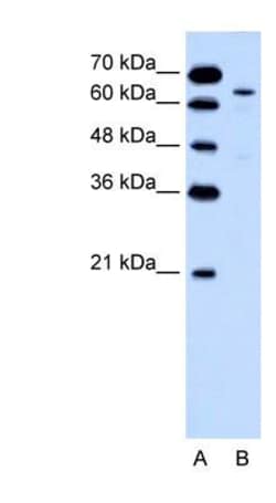 Cytokeratin 2 Antibody, Novus Biologicals 0.05mg; Unlabeled:Antibodies,