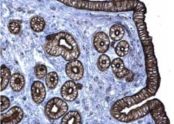 Cytokeratin 6a Antibody, Novus Biologicals 0.1mL; Unlabeled:Antibodies,