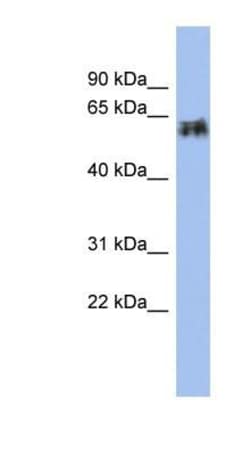 Cytokeratin 75 Antibody, Novus Biologicals 100 &mu;L | Buy Online | Novus Biologicals | Fisher Scientific