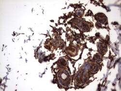 Cytokeratin 7 Antibody (OTI2A2), Novus Biologicals 0.1mL; Unlabeled:Antibodies,
