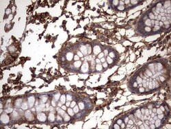Cytokeratin 7 Antibody (OTI2A2), Novus Biologicals 0.1mL; Unlabeled:Antibodies,