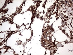 Cytokeratin 7 Antibody (OTI2A2), Novus Biologicals 0.1mL; Unlabeled:Antibodies,