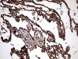 Cytokeratin 7 Antibody (OTI2A2), Novus Biologicals 0.1mL; Unlabeled:Antibodies,