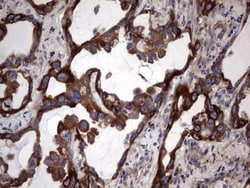 Cytokeratin 7 Antibody (OTI2A2), Novus Biologicals 0.1mL; Unlabeled:Antibodies,