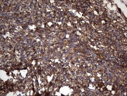 Cytokeratin 7 Antibody (OTI2A2), Novus Biologicals 0.1mL; Unlabeled:Antibodies,