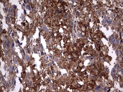 Cytokeratin 7 Antibody (OTI2A2), Novus Biologicals 0.1mL; Unlabeled:Antibodies,