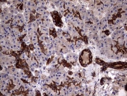 Cytokeratin 7 Antibody (OTI2A2), Novus Biologicals 0.1mL; Unlabeled:Antibodies,