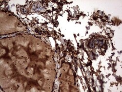 Cytokeratin 7 Antibody (OTI2A2), Novus Biologicals 0.1mL; Unlabeled:Antibodies,
