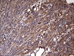 Cytokeratin 7 Antibody (OTI2A2), Novus Biologicals 0.1mL; Unlabeled:Antibodies,