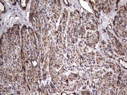 Cytokeratin 7 Antibody (OTI2A2), Novus Biologicals 0.1mL; Unlabeled:Antibodies,