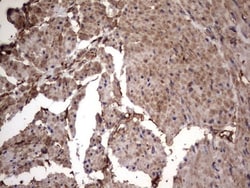 Cytokeratin 7 Antibody (OTI2A2), Novus Biologicals 0.1mL; Unlabeled:Antibodies,