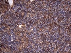 Cytokeratin 7 Antibody (OTI2A2), Novus Biologicals 0.1mL; Unlabeled:Antibodies,