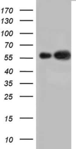 Cytokeratin 7 Antibody (OTI2A2), Novus Biologicals 0.1mL; Unlabeled:Antibodies,