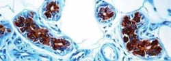 Cytokeratin 8/18 Antibody (5D3), Novus Biologicals:Antibodies:Primary Antibodies