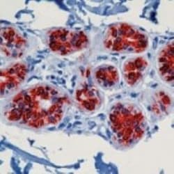 Cytokeratin 8/18 Antibody (5D3), Novus Biologicals:Antibodies:Primary Antibodies
