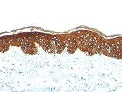 Cytokeratin, HMW Antibody (AE-3), Novus Biologicals:Antibodies:Primary