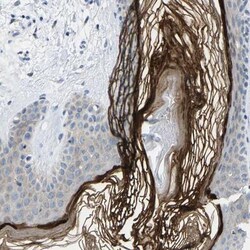 Cytokeratin, HMW Antibody, Novus Biologicals:Antibodies:Primary Antibodies