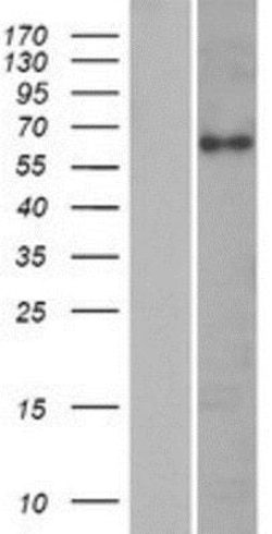 Novus Biologicals&trade;&nbsp;Cytokeratin, HMW Overexpression Lysate