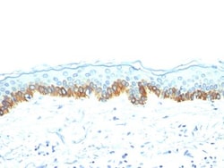 Cytokeratin, LMW Antibody (AE-1), Novus Biologicals:Antibodies:Primary
