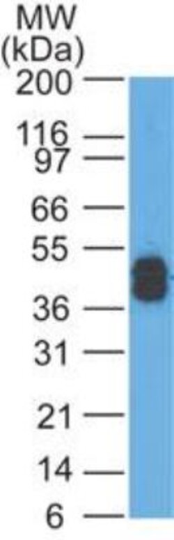 Cytokeratin, LMW Antibody (AE-1), Novus Biologicals:Antibodies:Primary