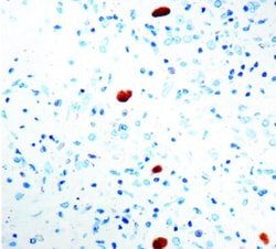 Cytomegalovirus Antibody (DDG9 and CCH2), Novus Biologicals 0.5mL; Unlabeled:Antibodies,