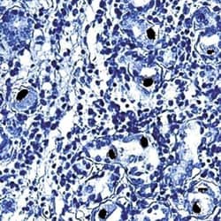 Cytomegalovirus Antibody (DDG9 and CCH2), Novus Biologicals 0.5mL; Unlabeled:Antibodies,