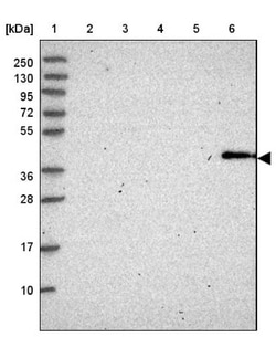 Cytosolic Sulfotransferase 2B1/SULT2B1 Antibody, Novus Biologicals:Antibodies:Primary