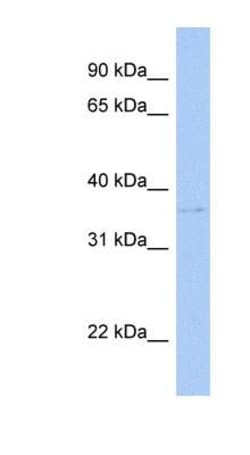 Cytosolic Sulfotransferase 1C2/SULT1C2 Antibody, Novus Biologicals 0.05mg;