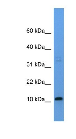 CYYR1 Rabbit anti-Rat, Polyclonal, Novus Biologicals 100&mu;L; Unlabeled:Antibodies,