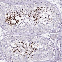 D2HGDH Antibody, Novus Biologicals:Antibodies:Primary Antibodies