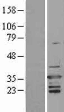 Novus Biologicals™ D4-GDI/RhoGDI2 Overexpression Lysate