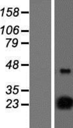 Novus Biologicals&trade;&nbsp;D4S234E Overexpression Lysate