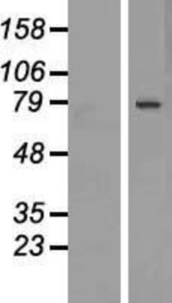 Novus Biologicals&trade;&nbsp;DACH1 Overexpression Lysate