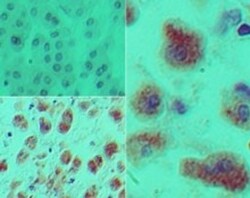DACH1 Antibody, Novus Biologicals:Antibodies:Primary Antibodies