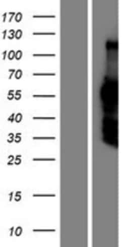 Novus Biologicals&trade;&nbsp;DACH2 Overexpression Lysate