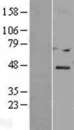 Novus Biologicals&trade;&nbsp;DACT3/Dapper 3 Overexpression Lysate