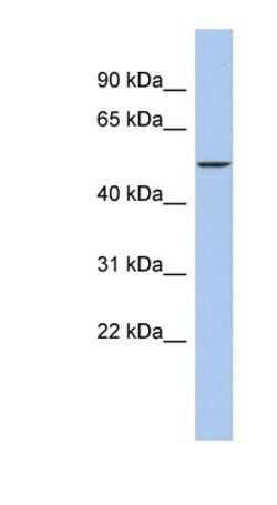DALRD3 Antibody, Novus Biologicals 100&mu;L; Unlabeled:Antibodies, Polyclonal