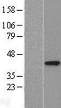 Novus Biologicals&trade;&nbsp;DALRD3 Overexpression Lysate