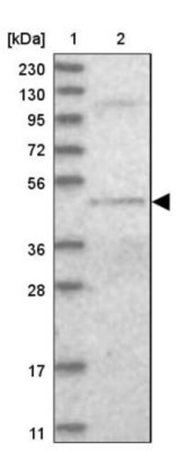 DALRD3 Antibody, Novus Biologicals:Antibodies:Primary Antibodies