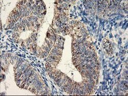 COCO/DAND5 Antibody (OTI2H3), Novus Biologicals 0.1mL; Unlabeled:Antibodies,
