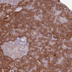 COCO/DAND5 Antibody, Novus Biologicals 25 &mu;L, Unlabeled:Antibodies,