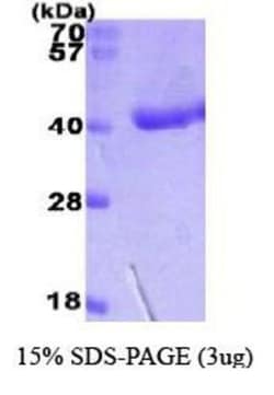 Novus Biologicals&trade;&nbsp;Recombinant Human DAO His Protein